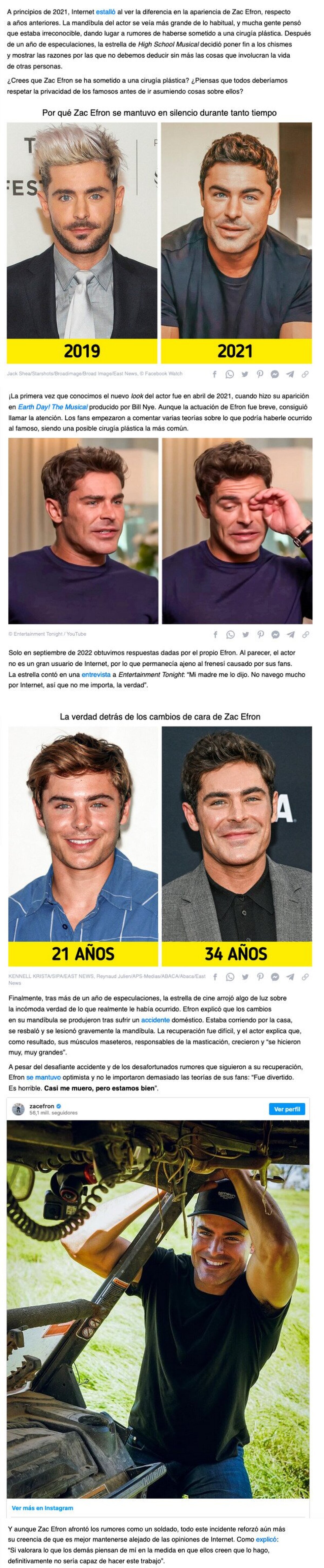 GALERÍA: Zac Efron confiesa qué le pasó realmente a su cara y responde a los rumores de cirugía plástica