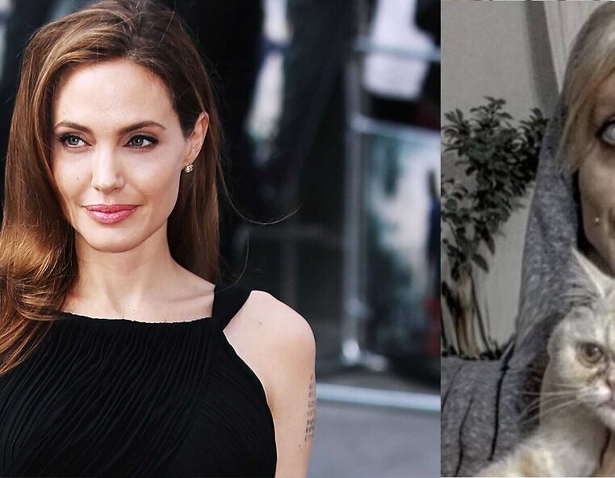 Una joven iraní se hace más de 50 cirugías para parecerse a Angelina Jolie
