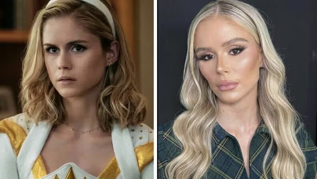 NOTICIA: Erin Moriarty borra sus redes sociales tras ser acusada por usar en exceso la cirugía estética