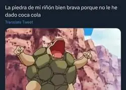 Los cálculos renales no son un juego